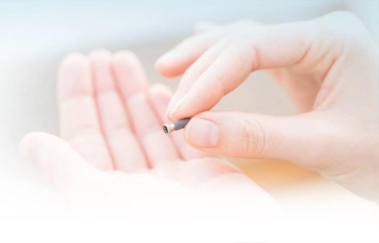 dr wiens zahnarzt eppelheim feste zaehne an einem tag 2